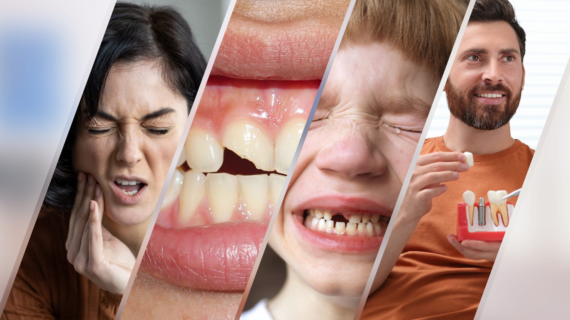 This image presents a montage of dental-related scenarios, highlighting various forms of tooth trauma like acute toothache and chipped or fractured teeth & jaw, all depicting an injury that can be considered a dental emergency.