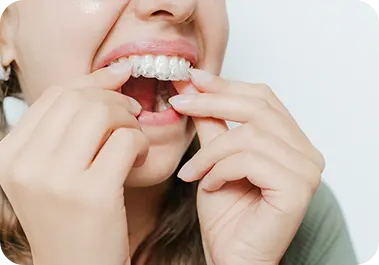 Orthodontics & Clear Aligners