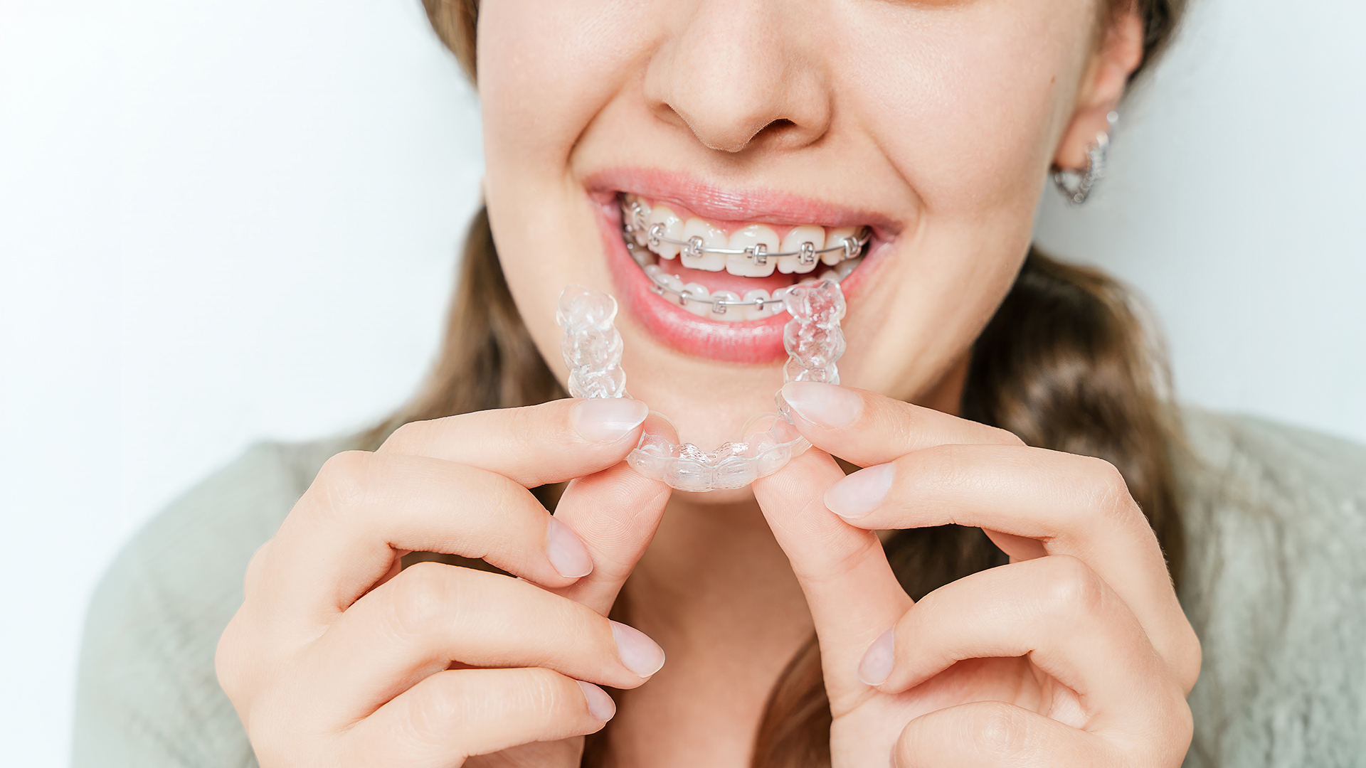 Close-up of a patient holding clear Invisalign aligners while wearing fixed braces for teeth straightening and smile correction.